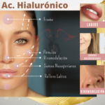 Relleno Facial con Ac. Hialurónico