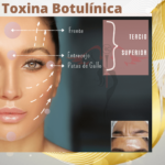 Toxina Botulínica